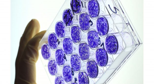 Haber padecido de dengue puede atenuar la infección con Zika