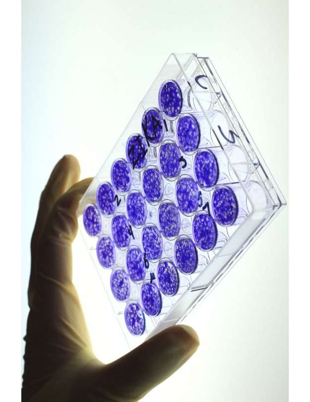 Haber padecido de dengue puede atenuar la infección con Zika Haber padecido de dengue puede atenuar la infección con Zika