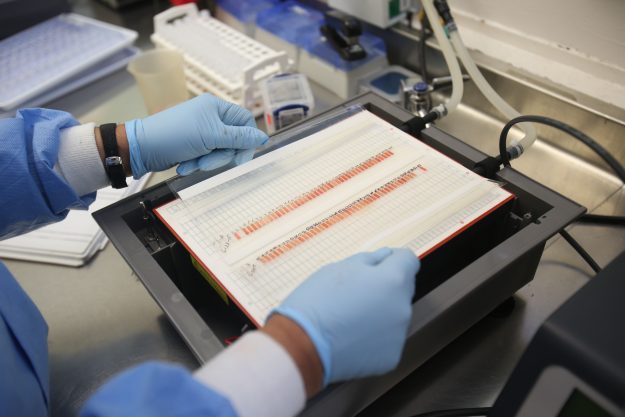 Centro Enfermedades Hereditarias-GLA18 Centro Enfermedades Hereditarias-GLA18