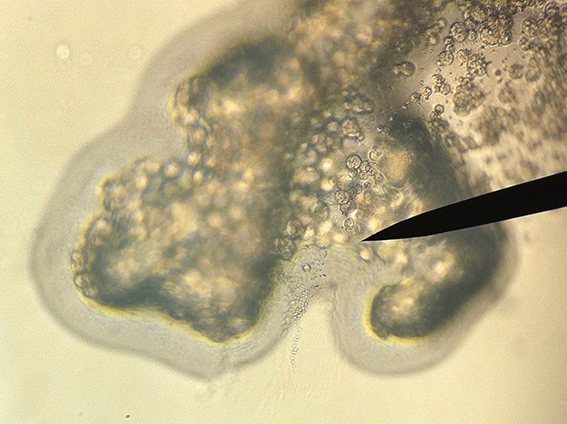 Puertorican strain Puertorican strain