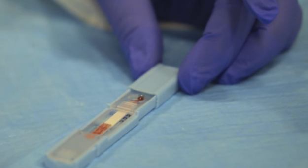 En unas dos a tres semanas los investigadores locales podrán someter los resultados finales de su investigación a la FDA en busca de su aprobación para la prueba que crearon. (Teresa Canino)