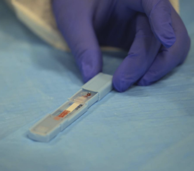 En unas dos a tres semanas los investigadores locales podrán someter los resultados finales de su investigación a la FDA en busca de su aprobación para la prueba que crearon. (Teresa Canino) En unas dos a tres semanas los investigadores locales podrán someter los resultados finales de su investigación a la FDA en busca de su aprobación para la prueba que crearon. (Teresa Canino)